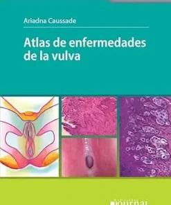 Atlas de enfermedades de la vulva (PDF)