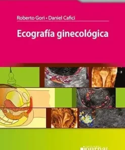 Ecografía Ginecológica (PDF)