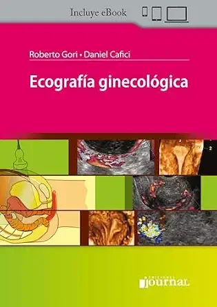 Ecografía Ginecológica (PDF) Ecografía Ginecológica (PDF)