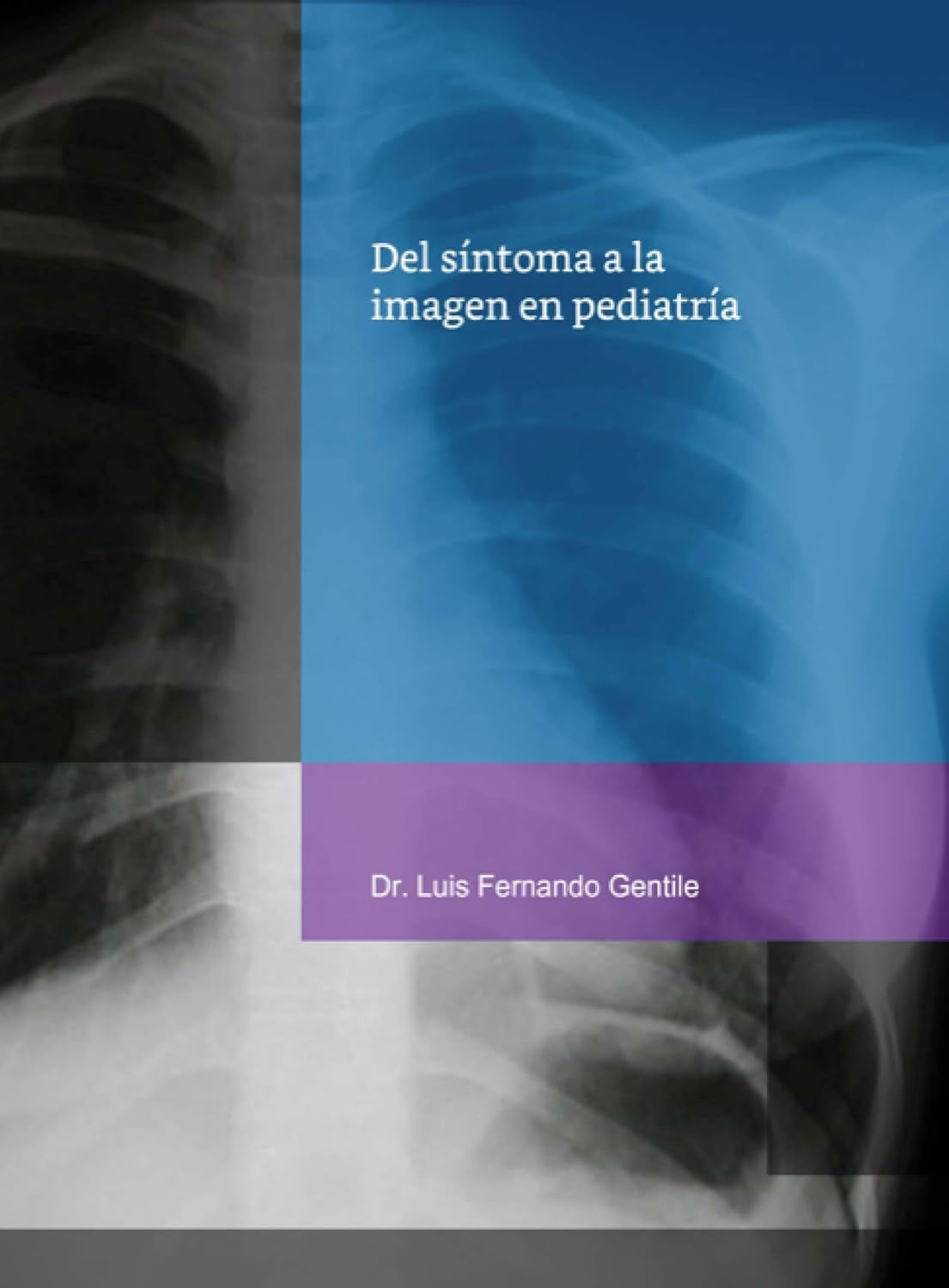 Del síntoma a la imagen en pediatría (Spanish Edition) (PDF) Del síntoma a la imagen en pediatría (Spanish Edition) (PDF)
