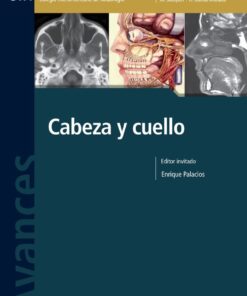 Avances En Diagnostico Por Imágenes Nº 9: Cabeza Y Cuello (PDF)
