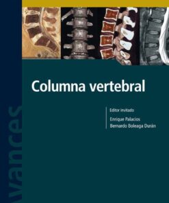 Avances En Diagnostico Por Imágenes Nº 10: Columna Vertebral (PDF)