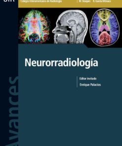 Avances En Diagnostico Por Imágenes Nº 4: Neurorradiologia (PDF)