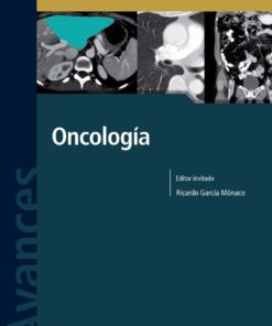 Avances En Diagnostico Por Imágenes Nº 11: Oncología (PDF)