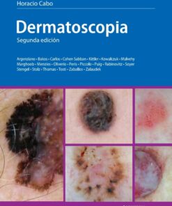Dermatoscopia, 2nd Edition (PDF)