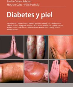 Diabetes y piel (PDF)