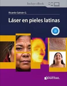 Láser en pieles latinas (PDF)