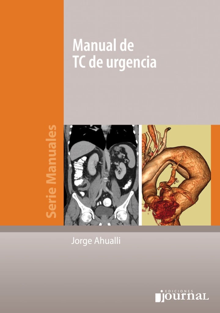 Manual De Tc De Urgencias (Serie Manuales) (PDF) Manual De Tc De Urgencias (Serie Manuales) (PDF)