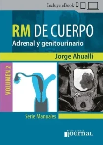 Manual de RM de Cuerpo Volumen 2: Adrenal y genitourinario (PDF)
