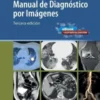 Paro cardiorrespiratorio. Cuidados agudos y atención integral (PDF)