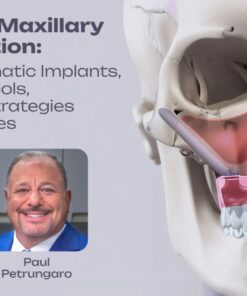 OHI-S Advanced Maxillary Rehabilitation Guided Zygomatic Implants, All-on-X Protocols, and Rescue Strategies for Failed Cases 3 lessons 3h 21min