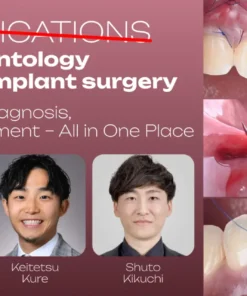 OHI-S Complications in Periodontology and Peri-implant Surgery Prevention, Diagnosis, and Management – All in One Place 5 lessons 4h 33min