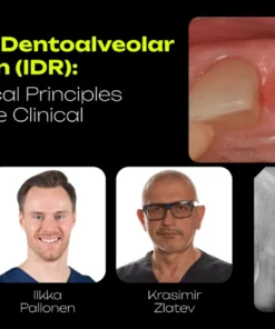 OHI-S Immediate Dentoalveolar Restoration (IDR) From Biological Principles to Predictable Clinical Outcomes 4 lessons 2h 43min