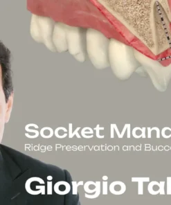 OHI-S Socket Management Ridge Preservation and Buccal Shield Techniques 3 lessons 57min