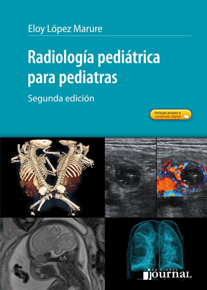 Radiología Pediatrica Para Pediatras, 2nd Edition (PDF) Radiología Pediatrica Para Pediatras, 2nd Edition (PDF)