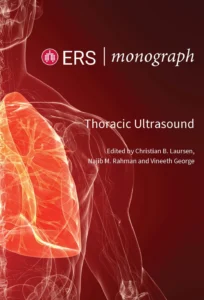 ERS Monographs: Thoracic Ultrasound (PDF) ERS Monographs: Thoracic Ultrasound (PDF)