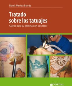 Tratado Sobre Los Tatuajes. Claves Para Su Eliminación Con Láser (PDF)