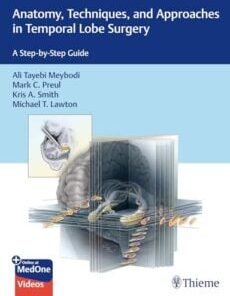 Anatomy, Techniques, and Approaches in Temporal Lobe Surgery: A Step-by-Step Guide (Original PDF from Publisher+Videos)