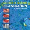 Adhesive Restoration of Endodontically Treated Teeth: Endodontics 4 (QuintEssentials of Dental Practice Book 40) (EPUB)