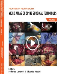 Frontiers in Neurosurgery Volume 2: Video Atlas of Spine Surgical Techniques (EPUB)