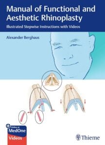 Manual of Functional and Aesthetic Rhinoplasty: Illustrated Stepwise Instructions with Videos (Original PDF from Publisher+Videos) Manual of Functional and Aesthetic Rhinoplasty: Illustrated Stepwise Instructions with Videos (Original PDF from Publisher+Videos)