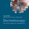 Graft-Versus-Host Disease: Methods and Protocols (Methods in Molecular Biology, 2907) (PDF)