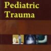 Fracture Treatment Methods (EPUB)